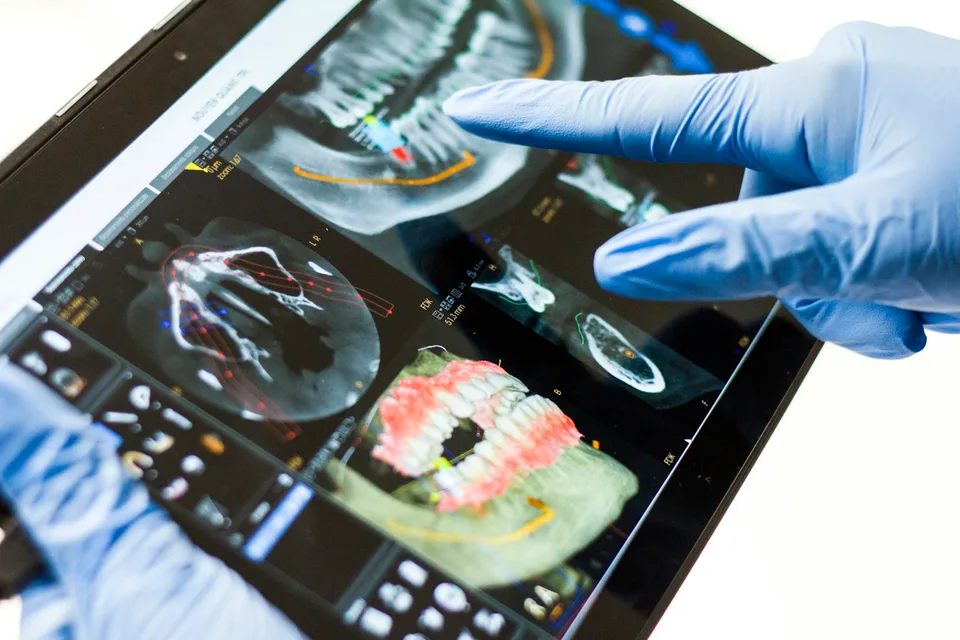 Dito guantato che indica una radiografia dentale tridimensionale sullo schermo di un tablet